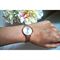 ساعت مچی زنانه اسکاگن(SKAGEN) مدل SKW2151